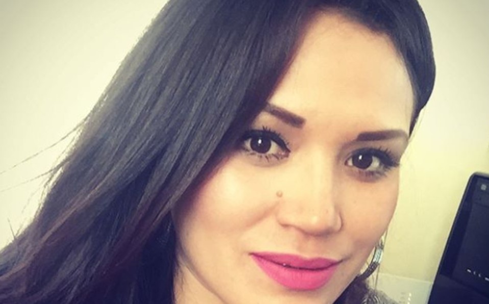 Gloria Rojas denuncia que fue atacada con ácido, pide apoyo Fama