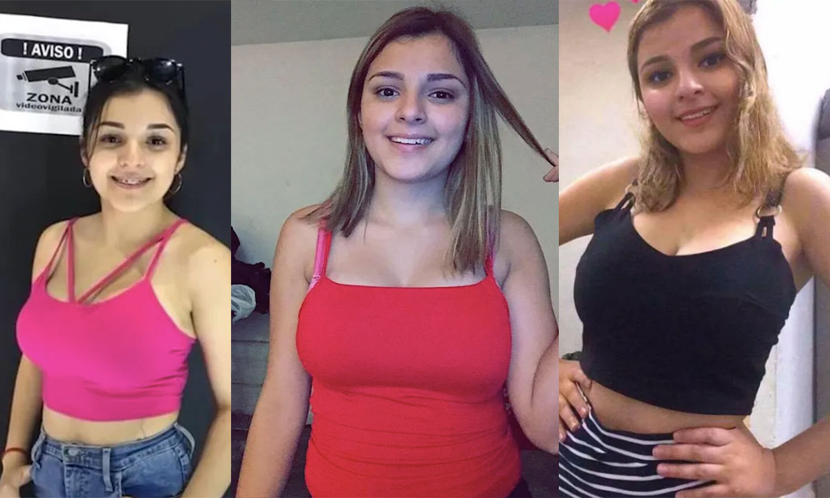 Karely ruiz antes de las operaciones