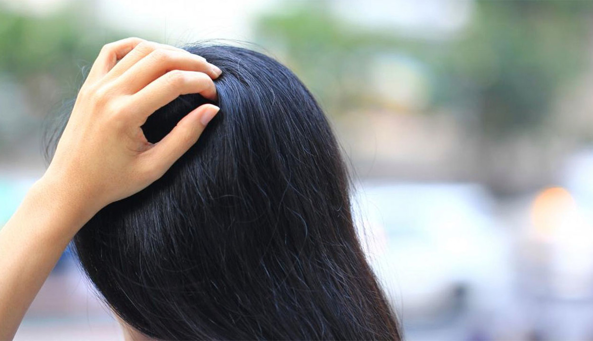 Cuero cabelludo seco remedios caseros para eliminarlo Fama