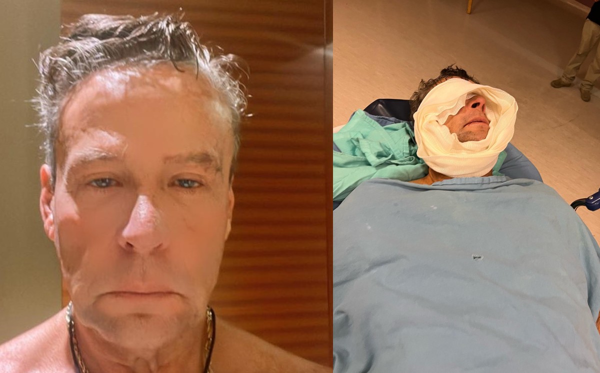 Alfredo Adame pública alarmantes fotos tras su cirugía Fama