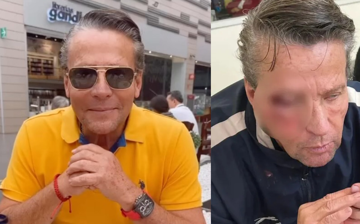 Alfredo Adame llega a acuerdo económico tras golpiza “Para chicles" Fama