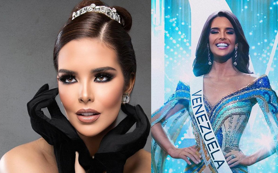 Miss Venezuela Así lucía Amanda Dudamen antes de su cirugía de rostro