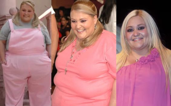 Sheyla Tadeo: Antes y después de perder 58 kilos y donar su piel