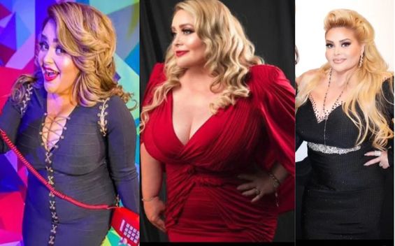 Sheyla Tadeo: Antes y después de perder 58 kilos y donar su piel