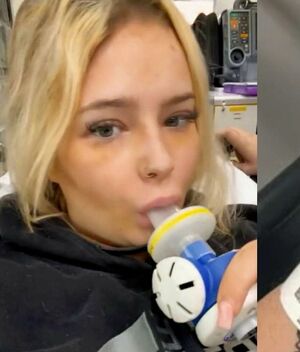 Muere influencer tras grabar video inhalando gas de la risa