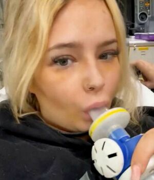Muere influencer tras grabar video inhalando gas de la risa