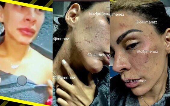 Reviven fotos de la detención y agresión de Eleazar Gómez a su exnovia