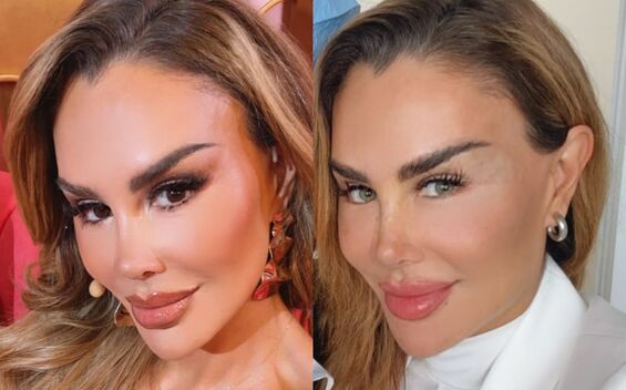 ¿Cuánto pagó Ninel Conde por cambiar el color de sus ojos?