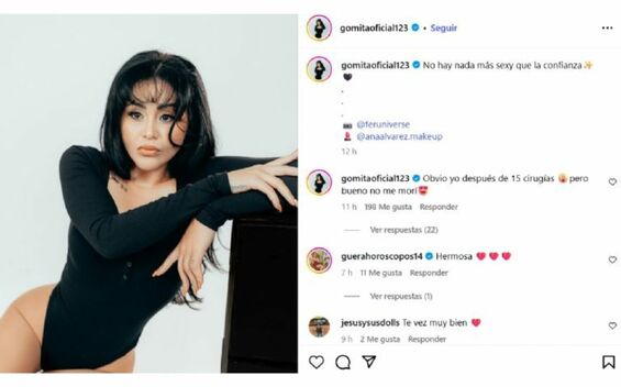 Gomita muestra su cambio tras someterse a 15 cirugías estéticas