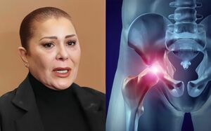 Alejandra Guzmán muestra su cadera tras su última cirugía (Instagram)