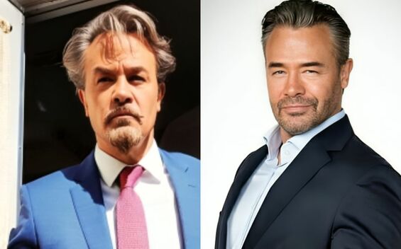 Sergio Sendel se sometió a tratamiento estético para lucir más joven