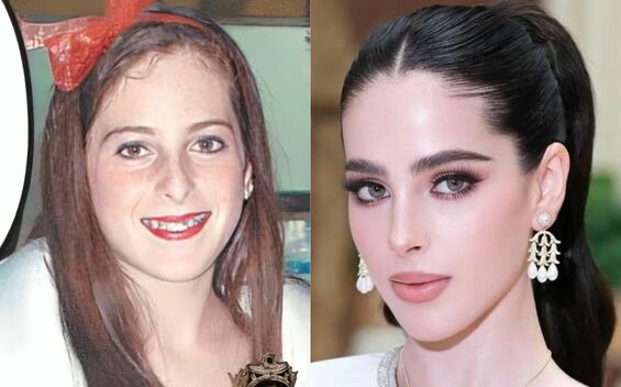 Fotografías de Fátima Bosch antes de sus supuestas cirugías plásticas (Instagram)