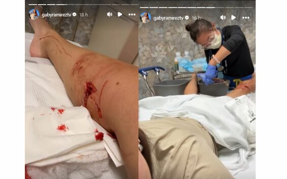 Gaby Ramírez es hospitalizada tras ser atacada por un perro