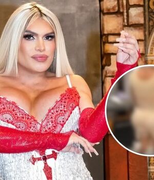 Wendy Guevara luce radical cambio físico tras su cirugía estética