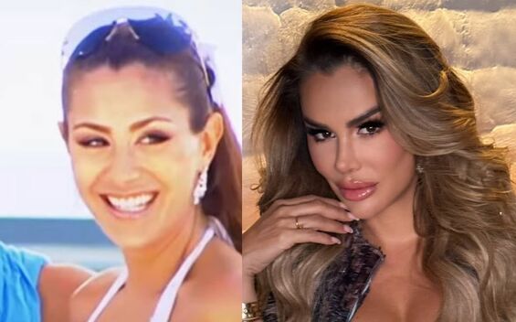 Ninel Conde: Antes y después de la cantante