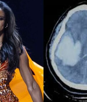Miss Jamaica será repatriada tras hemorragia craneal; sigue grave (Instagram)