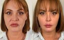 Gaby Spanic se hizo un tratamiento estético en Brasil (Instagram)