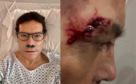 Pepillo Origel sufre grave accidente y muestra su herida