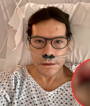 Pepillo Origel sufre grave accidente y muestra su herida