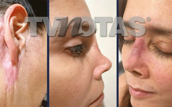 Conductora denuncia haber quedado desfigurada por cirugía estética (TVNotas)