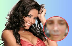 Conductora denuncia haber quedado desfigurada por cirugía estética