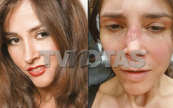 Conductora denuncia haber quedado desfigurada por cirugía estética (TVNotas)