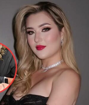 Melenie Carmona se somete a procedimiento estético; así luce