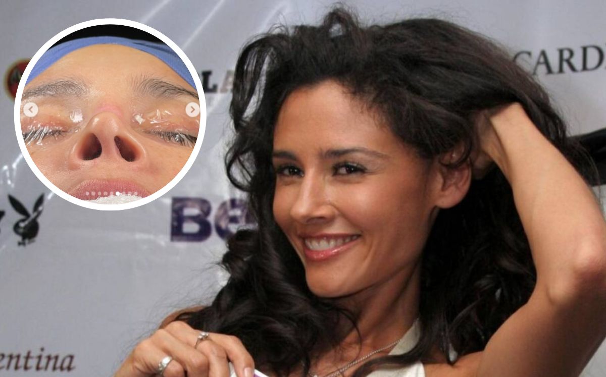 Rinoplastia para hombres: cómo encontrar el equilibrio adecuado para su  nueva nariz - CK Health Turkey, image size:1200x747