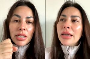 Gaby Ramírez muestra la mordida de perro que le destrozó la pierna (Instagram)