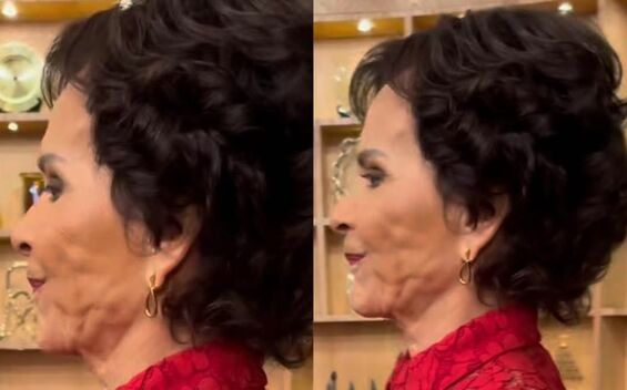 Pati Chapoy preocupa tras ser captada con “bultos” en su rostro