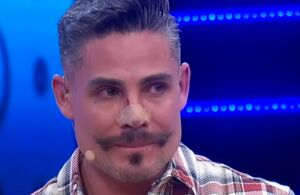 Conductor de ‘Enamorándonos’ revela cómo lo desfiguraron en cirugía  (Instagram)