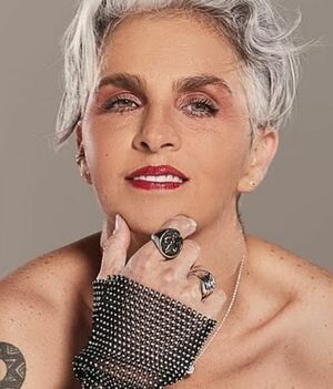 Federica Quijano recibe injerto de cadáver tras sufrir accidente