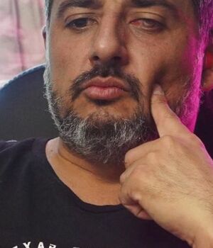 Diego Mesaglio actualiza todos los detalles de sus problemas en la vista (Foto: Instagram @mesagliodiego)