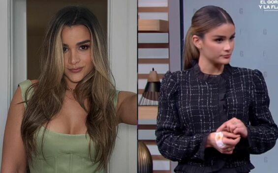 Conductora de ‘El gordo y la flaca’ sufre quemaduras tras accidente