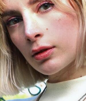 Imelda Tuñón sufrió algunos daños en el rostro: ¿Qué le pasó? (Instagram)