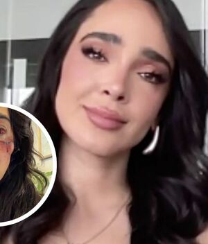 Manelyk González reaparece con golpes y genera preocupación (Instagram)