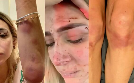 Edna Monroy denuncia agresión de su expareja y difunde pruebas