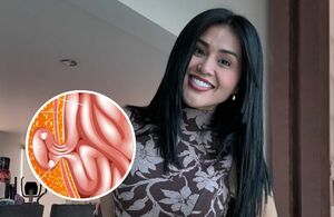 ¿Qué es la hernia de Petersen, padecimiento que sufrió Gomita?