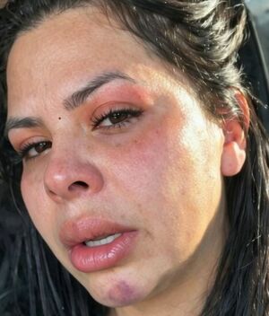 Banda Recoditos: Fernanda Redondo intentó lesionarse con un cuchillo (Instagram)