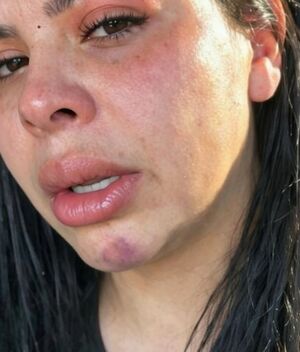 Banda Recoditos: Fernanda Redondo intentó lesionarse con un cuchillo (Instagram)