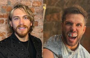 Aldo de Nigris se lanza contra Nicola Porcella tras lesión que sufrió