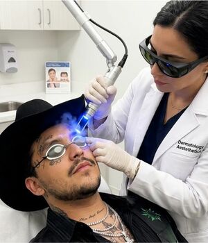 Nodal se somete a tratamiento para quitarse los tatuajes de la cara (Foto: Gemini)