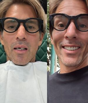 Esto se sabe sobre el accidente de Fernando Reina que lo dejó chimuelo (Instagram)