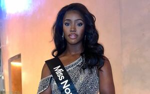 Muere reina de belleza a los 22 años por extraña y agresiva enfermedad