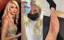 Taylor Momsen es hospitalizada en CDMX por picadura de araña (Instagram)