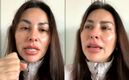 Gaby Ramírez muestra la mordida de perro que le destrozó la pierna (Instagram)