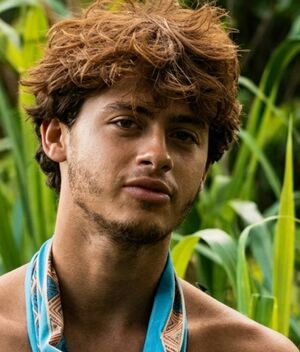 Participante de ‘Survivor' se amputa la pierna tras accidente