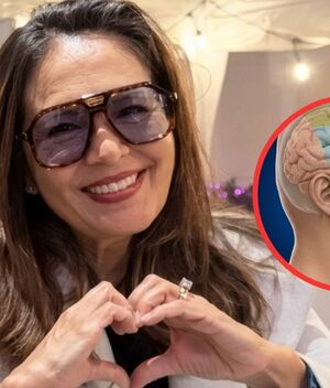 ¿Qué es la neuralgia del trigémino? Enfermedad de Yolanda Andrade