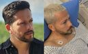 Carlos Guerrero Warrior es operado tras no poder respirar (Instagram)