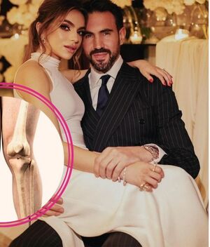 Rodillas de Pablo Bernot, esposo de Sofía Castro, se viralizan en redes sociales (Foto: Redes Sociales)